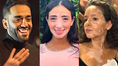 البطلة الحقيقية لحكاية لازم أعيش : جميلة عوض ساندتني قبل تصوير المسلسل ورامي جمال دعمني