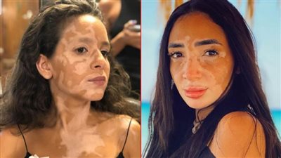 لُجينة صلاح : لهذه الأسباب لن أظهر في الحلقة الأخيرة من حكاية لازم أعيش مع جميلة عوض