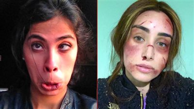 هنا الزاهد وروبي .. عندما يظهر الوجه الآخر على السوشيال ميديا