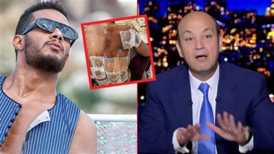 محمد رمضان : الإعلام تجاهل إصابتي وعمرو أديب فتح النار عليّ بتهمة ماليش دخل فيها
