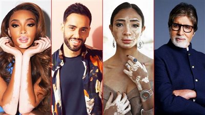 اليوم العالمي للبهاق .. من هم أشهر الذين أصيبوا بالمرض؟