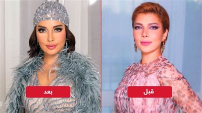 فيلر وبوتكس وتكساس ستايل .. ماذا فعلت أصالة في وجهها ؟ 